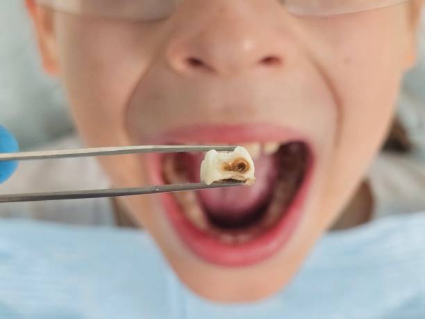 Best Pediatric Emergency Dentist in Priest River, ID